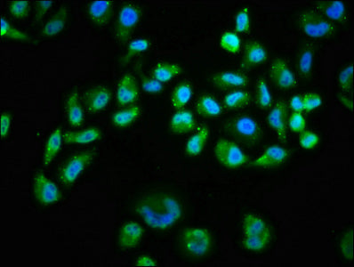 Immunofluorescence staining of Hela cells(treated with 100mM EGF for 20min) with RAC07594 at 1:68,counter-stained with DAPI. The cells were fixed in 4% formaldehyde, permeabilized using 0.2% Triton X-100 and blocked in 10% normal Goat Serum. The cells were then incubated with the antibody overnight at 4?. The secondary antibody was Alexa Fluor 488-congugated AffiniPure Goat Anti-Rabbit IgG (H+L).
