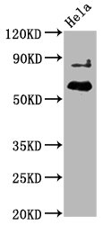 Western Blot; Positive WB detected in Hela whole cell lysate; All lanes Phospho-AKT1 antibody at 2.25ug/ml; Secondary; Goat polyclonal to rabbit IgG at 1/50000 dilution; Predicted band size: 60 KDa; Observed band size: 60 KDa