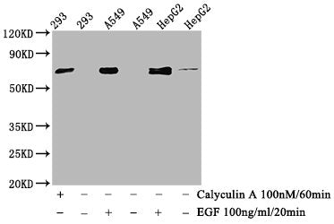 Western Blot; Positive WB detected in 293 whole cell lysate,A549 whole cell lysate,HepG2 whole cell lysate(treated with Calyculin A or EGF); All lanes Phospho-ATF2 antibody at 1.015ug/ml; Secondary; Goat polyclonal to rabbit IgG at 1/50000 dilution; Predicted band size: 70 KDa; Observed band size: 70 KDa