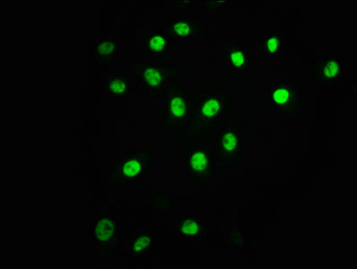 Immunofluorescence staining of A549 cells(treated with 100mM EGF for 20min) with RAC07596 at 1:63,counter-stained with DAPI. The cells were fixed in 4% formaldehyde, permeabilized using 0.2% Triton X-100 and blocked in 10% normal Goat Serum. The cells were then incubated with the antibody overnight at 4?. The secondary antibody was Alexa Fluor 488-congugated AffiniPure Goat Anti-Rabbit IgG (H+L).