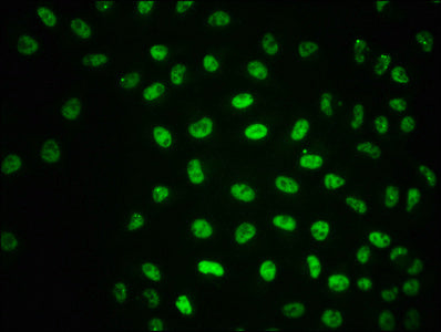 Immunofluorescence staining of Hela cells with RAC07597 at 1:100,counter-stained with DAPI. The cells were fixed in 4% formaldehyde, permeabilized using 0.2% Triton X-100 and blocked in 10% normal Goat Serum. The cells were then incubated with the antibody overnight at 4?. The secondary antibody was Alexa Fluor 488-congugated AffiniPure Goat Anti-Rabbit IgG (H+L).