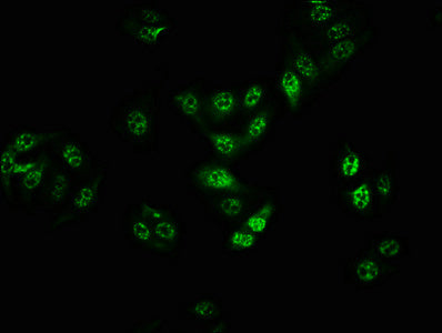 Immunofluorescence staining of HepG2 cells with RAC07598 at 1:100,counter-stained with DAPI. The cells were fixed in 4% formaldehyde, permeabilized using 0.2% Triton X-100 and blocked in 10% normal Goat Serum. The cells were then incubated with the antibody overnight at 4?. The secondary antibody was Alexa Fluor 488-congugated AffiniPure Goat Anti-Rabbit IgG (H+L).