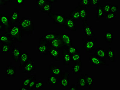 Immunofluorescence staining of Hela cells with RAC07600 at 1:100,counter-stained with DAPI. The cells were fixed in 4% formaldehyde, permeabilized using 0.2% Triton X-100 and blocked in 10% normal Goat Serum. The cells were then incubated with the antibody overnight at 4?. The secondary antibody was Alexa Fluor 488-congugated AffiniPure Goat Anti-Rabbit IgG (H+L).