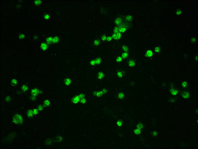 Immunofluorescence staining of 293T cells(treated with 50nM Calyculin A for 30min) with RAC07601 at 1:100,counter-stained with DAPI. The cells were fixed in 4% formaldehyde, permeabilized using 0.2% Triton X-100 and blocked in 10% normal Goat Serum. The cells were then incubated with the antibody overnight at 4?. The secondary antibody was Alexa Fluor 488-congugated AffiniPure Goat Anti-Rabbit IgG (H+L).