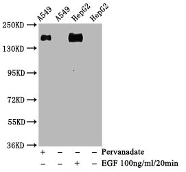 Western Blot; Positive WB detected in A549 whole cell lysate epG2 whole cell lysate(treated with EGF or Pervanadate); All lanes Phospho-EGFR antibody at 1.28ug/ml; Secondary; Goat polyclonal to rabbit IgG at 1/50000 dilution; Predicted band size: 175 KDa; Observed band size: 175 KDa