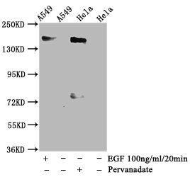 Western Blot; Positive WB detected in A549 whole cell lysate,Hela whole cell lysate(treated with Pervanadate or EGF); All lanes Phospho-EGFR antibody at 1.35ug/ml; Secondary; Goat polyclonal to rabbit IgG at 1/50000 dilution; Predicted band size: 170 KDa; Observed band size: 170 KDa