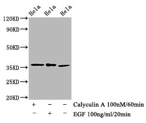 Western Blot; Positive WB detected in Hela whole cell lysate(treated with Calyculin A or EGF) ; All lanes Phospho-EIF2S1 antibody at 1.48ug/ml; Secondary; Goat polyclonal to rabbit IgG at 1/50000 dilution; Predicted band size: 36 KDa; Observed band size: 36 KDa