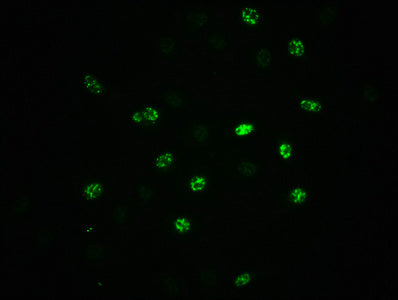 Immunofluorescence staining of A549 cells(treated with 100ng/ml EGF for 20min) with RAC07604 at 1:100,counter-stained with DAPI. The cells were fixed in 4% formaldehyde, permeabilized using 0.2% Triton X-100 and blocked in 10% normal Goat Serum. The cells were then incubated with the antibody overnight at 4?. The secondary antibody was Alexa Fluor 488-congugated AffiniPure Goat Anti-Rabbit IgG (H+L).