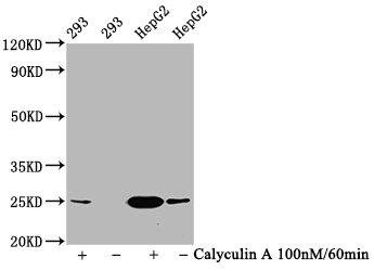 Western Blot; Positive WB detected in 293 whole cell lysate,HepG2 whole cell lysate(treated with Calyculin A or not); All lanes Phospho-EIF4E antibody at 1.2ug/ml; Secondary; Goat polyclonal to rabbit IgG at 1/50000 dilution; Predicted band size: 25 KDa; Observed band size: 25 KDa