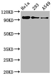 Western Blot; Positive WB detected in Hela whole cell lysate 93 whole cell lysate 549 whole cell lysate; All lanes Phospho-FOXO3 antibody at 0.96ug/ml; Secondary; Goat polyclonal to rabbit IgG at 1/50000 dilution; Predicted band size: 97 KDa; Observed band size: 97 KDa