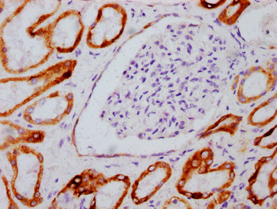 IHC image of RAC07610 diluted at 1:100 and staining in paraffin-embedded human kidney tissue performed on a Leica BondTM system. After dewaxing and hydration, antigen retrieval was mediated by high pressure in a citrate buffer (pH 6.0). Section was blocked with 10% normal goat serum 30min at RT. Then primary antibody (1% BSA) was incubated at 4? overnight. The primary is detected by a biotinylated secondary antibody and visualized using an HRP conjugated SP system.