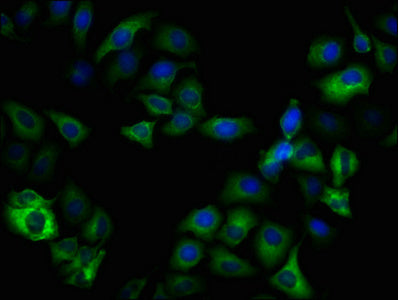 Immunofluorescence staining of Hela cells(treated with 50mM Calyculin A for 30min) with RAC07610 at 1:100,counter-stained with DAPI. The cells were fixed in 4% formaldehyde, permeabilized using 0.2% Triton X-100 and blocked in 10% normal Goat Serum. The cells were then incubated with the antibody overnight at 4?. The secondary antibody was Alexa Fluor 488-congugated AffiniPure Goat Anti-Rabbit IgG (H+L).