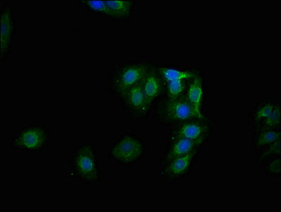 Immunofluorescence staining of HepG2 cells with RAC07611 at 1:100,counter-stained with DAPI. The cells were fixed in 4% formaldehyde, permeabilized using 0.2% Triton X-100 and blocked in 10% normal Goat Serum. The cells were then incubated with the antibody overnight at 4?. The secondary antibody was Alexa Fluor 488-congugated AffiniPure Goat Anti-Rabbit IgG (H+L).