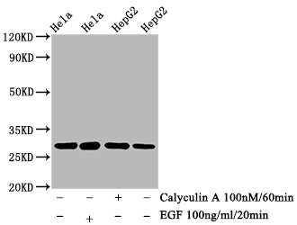 Western Blot; Positive WB detected in Hela whole cell lysate epG2 whole cell lysate(treated with Calyculin A or EGF); All lanes Phospho-HSPB1 antibody at 0.73ug/ml; Secondary; Goat polyclonal to rabbit IgG at 1/50000 dilution; Predicted band size: 27 KDa; Observed band size: 27 KDa