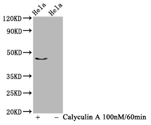 Western Blot; Positive WB detected in Hela whole cell lysate(treated with Calyculin A or not); All lanes Phospho-IRF3 antibody at 1.03ug/ml; Secondary; Goat polyclonal to rabbit IgG at 1/50000 dilution; Predicted band size: 47 KDa; Observed band size: 47 KDa