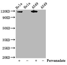 Western Blot; Positive WB detected in Hela whole cell lysate,A549 whole cell lysate(treated with Pervanadate or not); All lanes Phospho-JAK2 antibody at 0.75ug/ml; Secondary; Goat polyclonal to rabbit IgG at 1/50000 dilution; Predicted band size: 120 KDa; Observed band size: 120 KDa