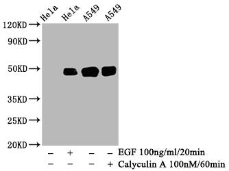 Western Blot; Positive WB detected in: Hela whole cell lysate, A549 whole cell lysate(treated with Calyculin A or EGF); All lanes: Phospho-JUN antibody at 0.95ug/ml; Secondary; Goat polyclonal to rabbit IgG at 1/50000 dilution; Predicted band size: 48 KDa; Observed band size: 48 KDa