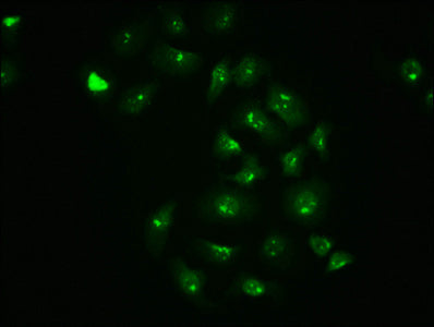 Immunofluorescence staining of A549 cells with RAC07616 at 1:100,counter-stained with DAPI. The cells were fixed in 4% formaldehyde, permeabilized using 0.2% Triton X-100 and blocked in 10% normal Goat Serum. The cells were then incubated with the antibody overnight at 4Â°C. The secondary antibody was Alexa Fluor 488-congugated AffiniPure Goat Anti-Rabbit IgG (H+L).