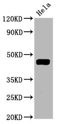 Western Blot; Positive WB detected in Hela whole cell lysate; All lanes Phospho-MAP2K1 antibody at 1.645ug/ml; Secondary; Goat polyclonal to rabbit IgG at 1/50000 dilution; Predicted band size: 45 KDa; Observed band size: 45 KDa