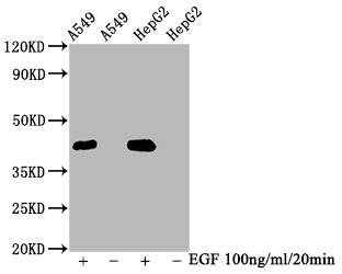 Western Blot; Positive WB detected in A549 whole cell lysate,HepG2 whole cell lysate(treated with EGF or not); All lanes Phospho-MAPK3 antibody at 2.35ug/ml; Secondary; Goat polyclonal to rabbit IgG at 1/50000 dilution; Predicted band size: 42 KDa; Observed band size: 42 KDa