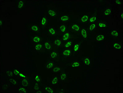 Immunofluorescence staining of Hela cells with RAC07618 at 1:100,counter-stained with DAPI. The cells were fixed in 4% formaldehyde, permeabilized using 0.2% Triton X-100 and blocked in 10% normal Goat Serum. The cells were then incubated with the antibody overnight at 4?. The secondary antibody was Alexa Fluor 488-congugated AffiniPure Goat Anti-Rabbit IgG (H+L).