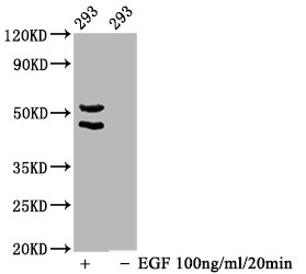 Western Blot; Positive WB detected in 293 whole cell lysate(treated with EGF or not); All lanes Phospho-MAPK8/MAPK9/MAPK10 antibody at 1.65ug/ml; Secondary; Goat polyclonal to rabbit IgG at 1/50000 dilution; Predicted band size: 46,54 KDa; Observed band size: 46,54 KDa