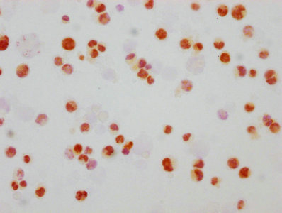 Immunocytochemistry analysis of RAC07620 diluted at 1:165 and staining in Hela cells(treated with 100ng/ml EGF for 4h) performed on a Leica BondTM system. The cells were fixed in 4% formaldehyde, permeabilized using 0.2% Triton X-100 and blocked with 10% normal goat serum 30min at RT. Then primary antibody (1% BSA) was incubated at 4? overnight. The primary is detected by a biotinylated secondary antibody and visualized using an HRP conjugated SP system.