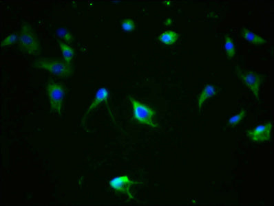 Immunofluorescence staining of SH-SY5Y cells with RAC07621 at 1:100,counter-stained with DAPI. The cells were fixed in 4% formaldehyde, permeabilized using 0.2% Triton X-100 and blocked in 10% normal Goat Serum. The cells were then incubated with the antibody overnight at 4?. The secondary antibody was Alexa Fluor 488-congugated AffiniPure Goat Anti-Rabbit IgG (H+L).