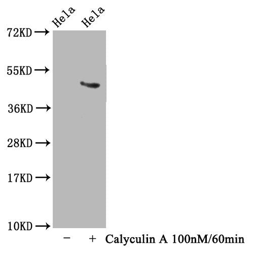 Western Blot; Positive WB detected in Hela whole cell lysate(treated with Calyculin A or not); All lanes Phospho-MAPT antibody at 1.63ug/ml; Secondary; Goat polyclonal to rabbit IgG at 1/50000 dilution; Predicted band size: 46 KDa; Observed band size: 46 KDa