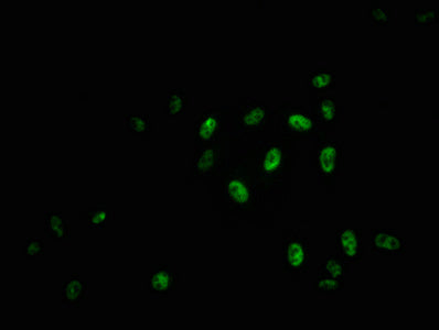 Immunofluorescence staining of Hela cells with RAC07624 at 1:100,counter-stained with DAPI. The cells were fixed in 4% formaldehyde, permeabilized using 0.2% Triton X-100 and blocked in 10% normal Goat Serum. The cells were then incubated with the antibody overnight at 4?. The secondary antibody was Alexa Fluor 488-congugated AffiniPure Goat Anti-Rabbit IgG (H+L).