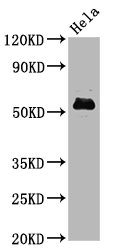 Western Blot; Positive WB detected in Hela whole cell lysate; All lanes Phospho-MYC antibody at 1.4ug/ml; Secondary; Goat polyclonal to rabbit IgG at 1/50000 dilution; Predicted band size: 57 KDa; Observed band size: 57 KDa