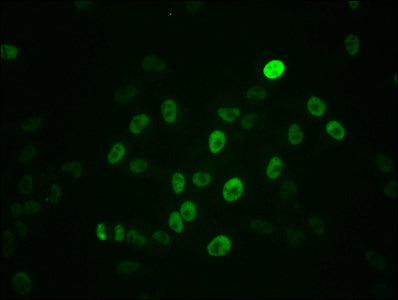 Immunofluorescence staining of Hela cells with RAC07625 at 1:100,counter-stained with DAPI. The cells were fixed in 4% formaldehyde, permeabilized using 0.2% Triton X-100 and blocked in 10% normal Goat Serum. The cells were then incubated with the antibody overnight at 4?. The secondary antibody was Alexa Fluor 488-congugated AffiniPure Goat Anti-Rabbit IgG (H+L).