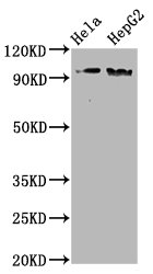 Western Blot; Positive WB detected in Hela whole cell lysate,HepG2 whole cell lysate; All lanes Phospho-NBN antibody at 1.98ug/ml; Secondary; Goat polyclonal to rabbit IgG at 1/50000 dilution; Predicted band size: 95 KDa; Observed band size: 95 KDa