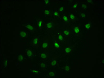 Immunofluorescence staining of A549 cells with RAC07628 at 1:100,counter-stained with DAPI. The cells were fixed in 4% formaldehyde, permeabilized using 0.2% Triton X-100 and blocked in 10% normal Goat Serum. The cells were then incubated with the antibody overnight at 4?. The secondary antibody was Alexa Fluor 488-congugated AffiniPure Goat Anti-Rabbit IgG (H+L).