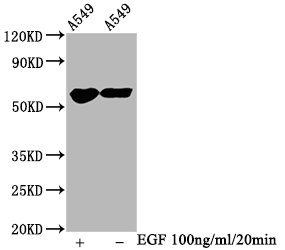 Western Blot; Positive WB detected in A549 whole cell lysate(treated with EGF or not); All lanes Phospho-PAK1/PAK2/PAK3 antibody at 1.2ug/ml; Secondary; Goat polyclonal to rabbit IgG at 1/50000 dilution; Predicted band size: 65 KDa; Observed band size: 65 KDa