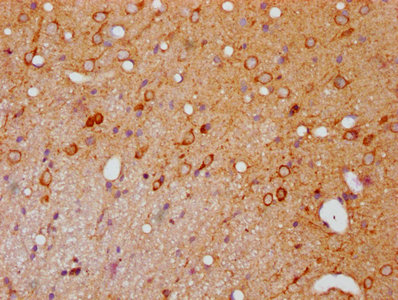 IHC image of RAC07629 diluted at 1:100 and staining in paraffin-embedded rat brain tissue performed on a Leica BondTM system. After dewaxing and hydration, antigen retrieval was mediated by high pressure in a citrate buffer (pH 6.0). Section was blocked with 10% normal goat serum 30min at RT. Then primary antibody (1% BSA) was incubated at 4? overnight. The primary is detected by a biotinylated secondary antibody and visualized using an HRP conjugated SP system.