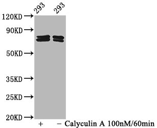 Western Blot; Positive WB detected in 293 whole cell lysate(treated with Calyculin A or not); All lanes Phospho-PAK4/PAK5/PAK6 antibody at 2.15ug/ml; Secondary; Goat polyclonal to rabbit IgG at 1/50000 dilution; Predicted band size: 64,75,80 KDa; Observed band size: 75,80 KDa
