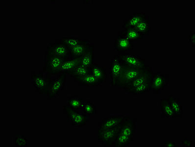 Immunofluorescence staining of HepG2 cells(treated with 50mM Calyculin A for 30min) with RAC07630 at 1:100,counter-stained with DAPI. The cells were fixed in 4% formaldehyde, permeabilized using 0.2% Triton X-100 and blocked in 10% normal Goat Serum. The cells were then incubated with the antibody overnight at 4?. The secondary antibody was Alexa Fluor 488-congugated AffiniPure Goat Anti-Rabbit IgG (H+L).