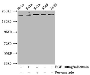 Western Blot; Positive WB detected in Hela whole cell lysate,A549 whole cell lysate(treated with EGF or Pervanadate); All lanes Phospho-PDGFRB antibody at 1.14ug/ml; Secondary; Goat polyclonal to rabbit IgG at 1/50000 dilution; Predicted band size: 190 KDa; Observed band size: 190 KDa