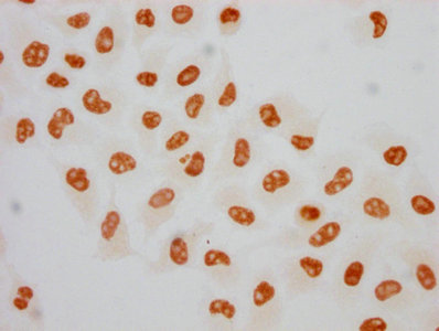 Immunocytochemistry analysis of RAC07632 diluted at 1:75 and staining in Hela cells(treated with 100ng/ml EGF for 4h) performed on a Leica BondTM system. The cells were fixed in 4% formaldehyde, permeabilized using 0.2% Triton X-100 and blocked with 10% normal goat serum 30min at RT. Then primary antibody (1% BSA) was incubated at 4? overnight. The primary is detected by a biotinylated secondary antibody and visualized using an HRP conjugated SP system.