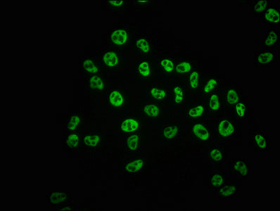 Immunofluorescence staining of Hela cells with RAC07632 at 1:100,counter-stained with DAPI. The cells were fixed in 4% formaldehyde, permeabilized using 0.2% Triton X-100 and blocked in 10% normal Goat Serum. The cells were then incubated with the antibody overnight at 4?. The secondary antibody was Alexa Fluor 488-congugated AffiniPure Goat Anti-Rabbit IgG (H+L).