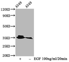 Western Blot; Positive WB detected in A549 whole cell lysate(treated with EGF or not); All lanes Phospho-PPP2CA antibody at 0.95ug/ml; Secondary; Goat polyclonal to rabbit IgG at 1/50000 dilution; Predicted band size: 35 KDa; Observed band size: 35 KDa
