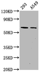 Western Blot; Positive WB detected in 293 whole cell lysate 549 whole cell lysate; All lanes Phospho-PRKAA2 antibody at 1.1ug/ml; Secondary; Goat polyclonal to rabbit IgG at 1/50000 dilution; Predicted band size: 62 KDa; Observed band size: 62 KDa