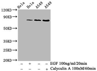 Western Blot; Positive WB detected in Hela whole cell lysate 549 whole cell lysate(treated with Calyculin A or EGF); All lanes Phospho-PRKCA antibody at 0.68ug/ml; Secondary; Goat polyclonal to rabbit IgG at 1/50000 dilution; Predicted band size: 80 KDa; Observed band size: 80 KDa