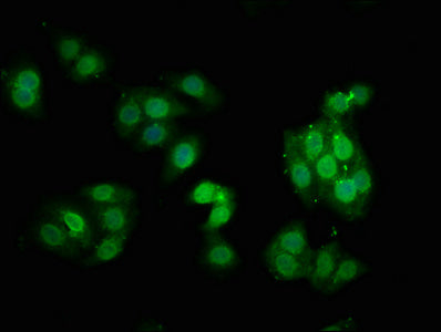 Immunofluorescence staining of HepG2 cells with RAC07635 at 1:100,counter-stained with DAPI. The cells were fixed in 4% formaldehyde, permeabilized using 0.2% Triton X-100 and blocked in 10% normal Goat Serum. The cells were then incubated with the antibody overnight at 4?. The secondary antibody was Alexa Fluor 488-congugated AffiniPure Goat Anti-Rabbit IgG (H+L).