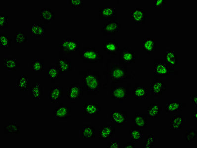 Immunofluorescence staining of Hela cells(treated with UV) with RAC07637 at 1:100,counter-stained with DAPI. The cells were fixed in 4% formaldehyde, permeabilized using 0.2% Triton X-100 and blocked in 10% normal Goat Serum. The cells were then incubated with the antibody overnight at 4?. The secondary antibody was Alexa Fluor 488-congugated AffiniPure Goat Anti-Rabbit IgG (H+L).