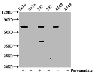 Western Blot; Positive WB detected in Hela whole cell lysate 93 whole cell lysate 549 whole cell lysate(treated with Pervanadate or not); All lanes Phospho-PTPN11 antibody at 0.65ug/ml; Secondary; Goat polyclonal to rabbit IgG at 1/50000 dilution; Predicted band size: 68 KDa; Observed band size: 68 KDa