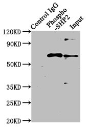 Immunoprecipitating Phospho-PTPN11 in Hela whole cell lysate treated with Pervanadate; Lane 1: Rabbit control IgG(1ug)instead of RAC07640 in Hela whole cell lysate treated with Pervanadate.For western blotting,a HRP-conjugated Protein G antibody was used as the secondary antibody (1/2000); Lane 2: RAC07640(3ug)+ Hela whole cell lysate treated with Pervanadate(1mg); Lane 3: Hela whole cell lysate treated with Pervanadate(20ug)