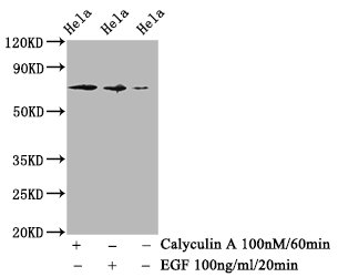 Western Blot; Positive WB detected in Hela whole cell lysate(treated with Calyculin A or EGF); All lanes Phospho-RAF1 antibody at 1.18ug/ml; Secondary; Goat polyclonal to rabbit IgG at 1/50000 dilution; Predicted band size: 73 KDa; Observed band size: 73 KDa