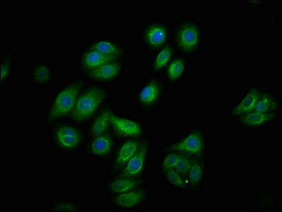 Immunofluorescence staining of HepG2 cells with RAC07642 at 1:100,counter-stained with DAPI. The cells were fixed in 4% formaldehyde, permeabilized using 0.2% Triton X-100 and blocked in 10% normal Goat Serum. The cells were then incubated with the antibody overnight at 4?. The secondary antibody was Alexa Fluor 488-congugated AffiniPure Goat Anti-Rabbit IgG (H+L).